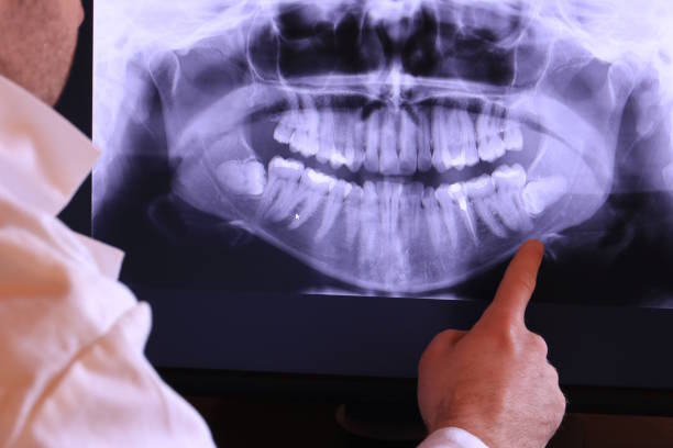 Best Broken Tooth Emergency  in Colwich, KS