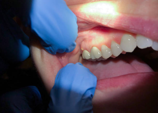 Best Dentist for Dental Trauma  in Colwich, KS
