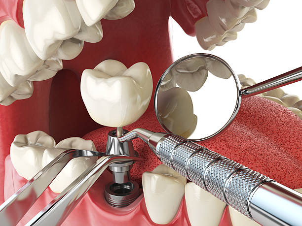 Best Tooth Infection Emergency Dentist  in Colwich, KS